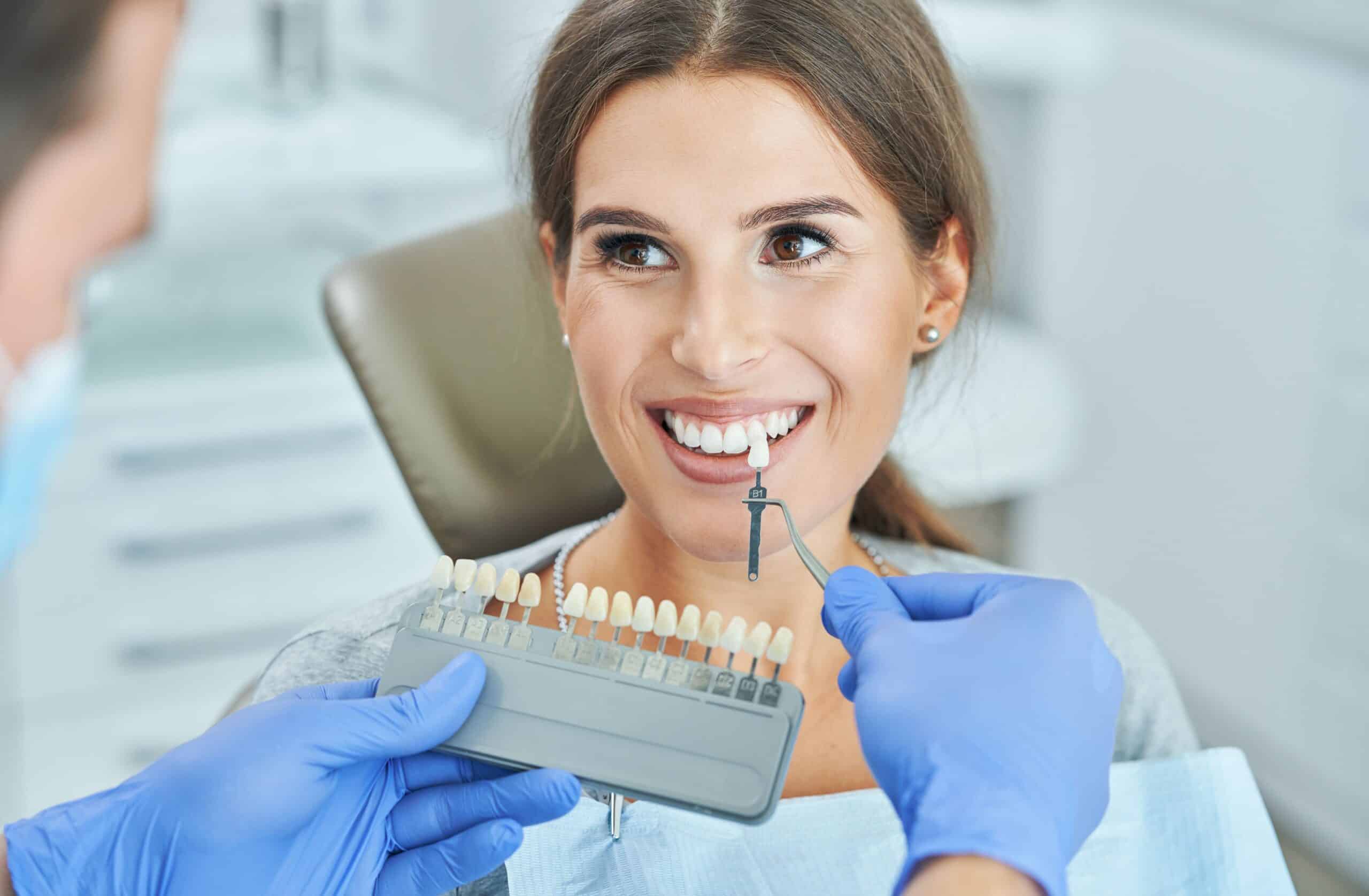 Teeth whitening